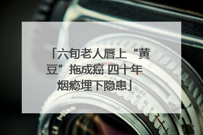 六旬老人唇上“黄豆”拖成癌 四十年烟瘾埋下隐患
